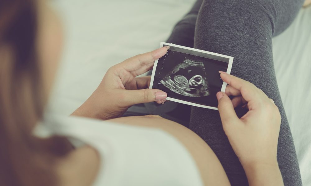 Assure Pregnancy Clinic